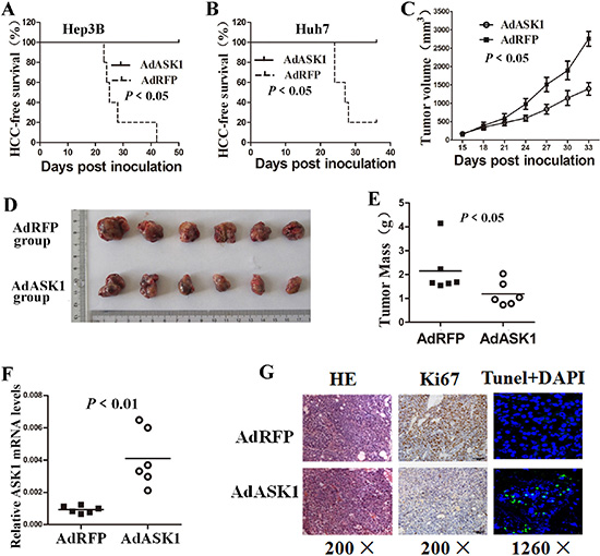 ASK1 overexpression suppresses tumorigenicity of HCC cells in mice.