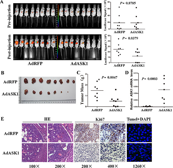Systemic injection of AdASK1 suppresses orthotopic hepatocellular carcinoma growth.