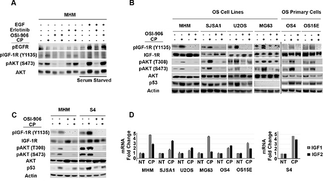 Cisplatin induces IGF-1R/AKT activation in osteosarcoma cells and it is accompanied by increased IGF 1/2 gene expression.