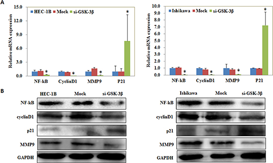 NF-kB, Cyclin D1, MMP9, and P21 expression is regulated by si-GSK-3&#x03B2; transfection.
