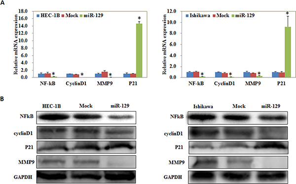 MiR-129 overexpression regulate NF-kB, Cyclin D1, MMP9, and P21 expression in vitro.