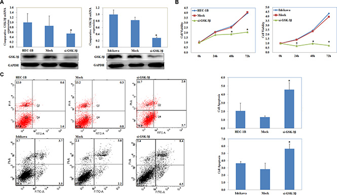 si-GSK-3&#x03B2; transfection suppressed EC cell proliferation, increased cell apoptosis.