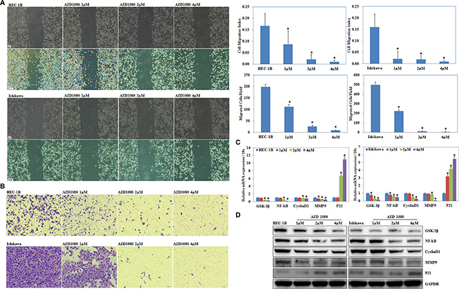 GSK-3&#x03B2; inhibitor AZD1080 suppressed EC cell migration and invasion and modulate NF-kB, Cyclin D1, MMP9, and P21 expression.