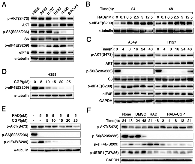 Mnk1 inhibitor CGP57380 abrogates the eIF4E phosphorylation induced by mTOR inhibitor RAD001 in vitro.