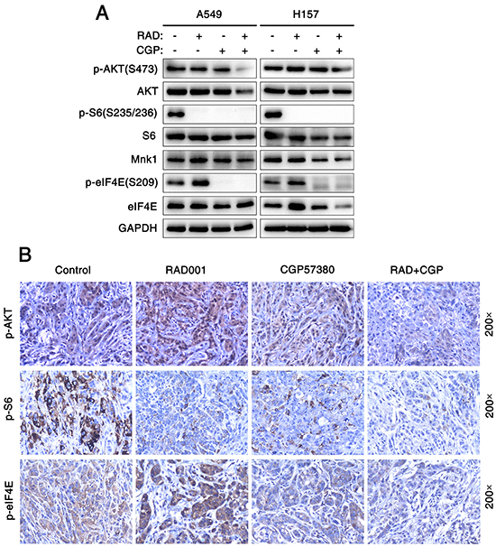Concomitant treatment with mTOR inhibitor and Mnk inhibitor attenuate eIF4E and AKT phosphorylation both in vitro and in vivo.