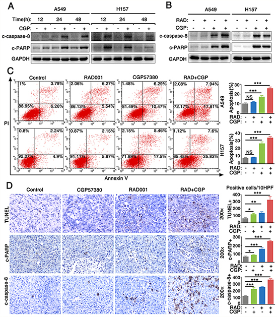 Combination of targeting both mTOR signaling and Mnk/eIF4E pathway induces cell apoptosis both in vitro and in vivo.