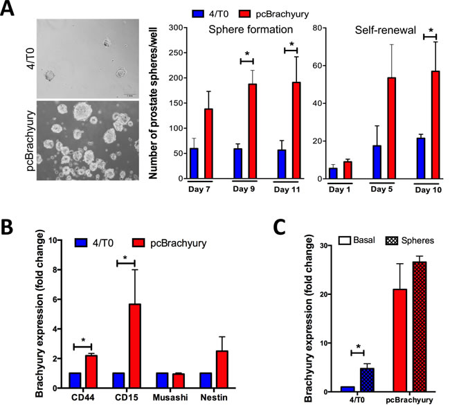 Brachyury promotes stem cell properties in PCa cells and is re-expressed under pressure conditions.