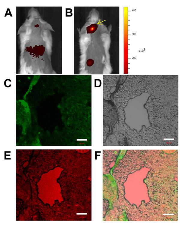 Immuno-histochemical imaging and analysis of RPMI8226 cell-derived xenotransplants.