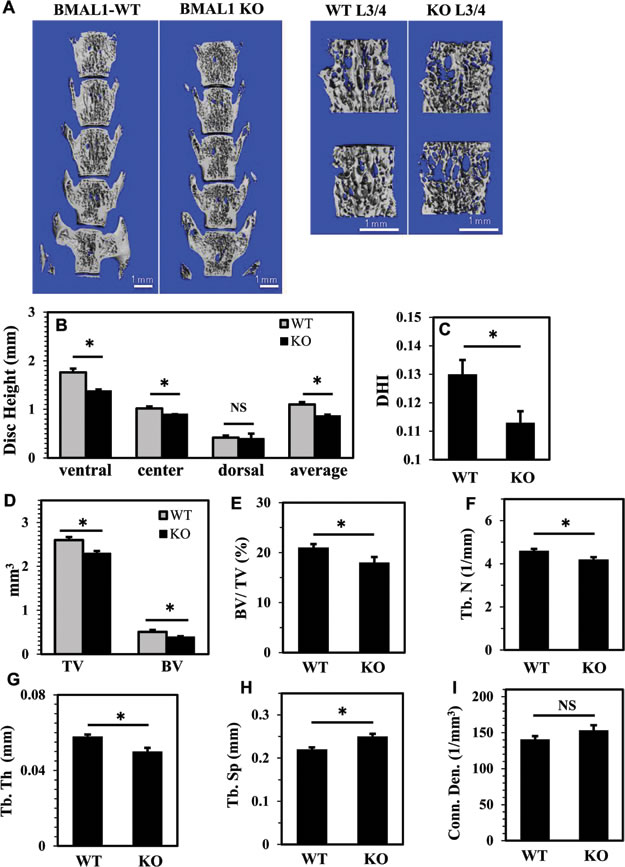 BMAL1 knockout mice (KO) evidence compromised disc height and vertebral bone health.