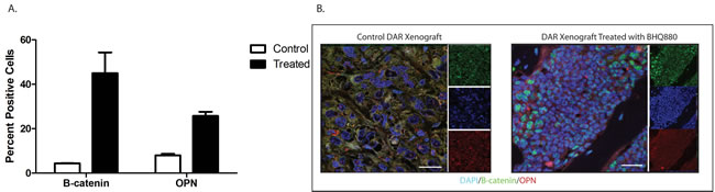Immunofluorescence studies of the DAR xenograft excised from control and BHQ880-treated mice.