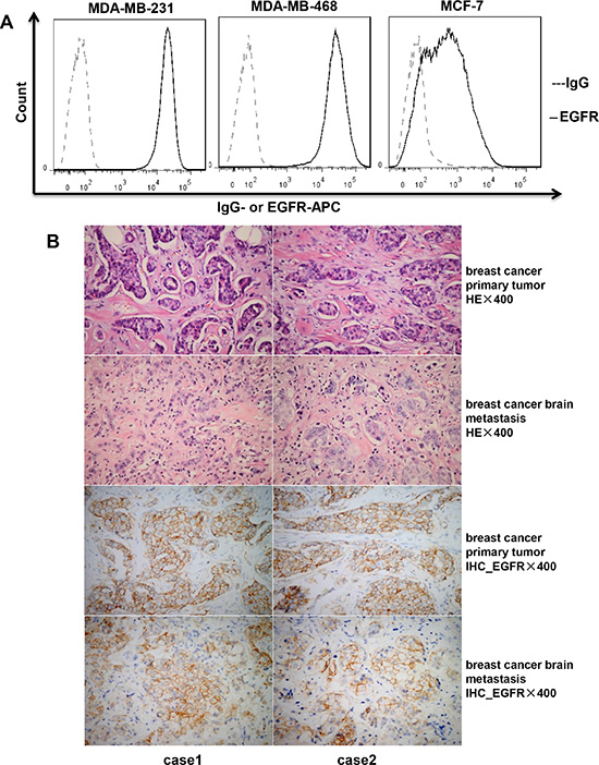Expression of EGFR in breast cancer cell lines and tissues.