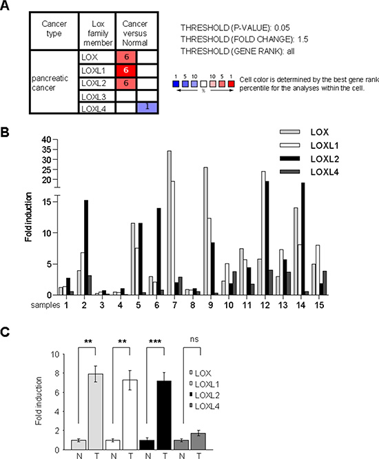 LOX activity increases in human PDAC.