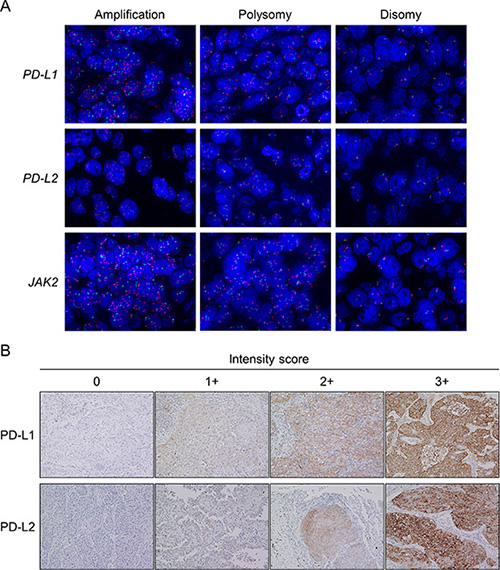Representative images of fluorescence in situ hybridization (FISH) for the PD-L1, PD-L2, and JAK2 genes and representative images of the immunohistochemistry (IHC) analysis for PD-L1 and PD-L2.