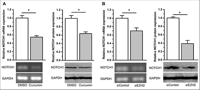 Curcumin and knockdown of EZH2 inhibited NOTCH1 expression.