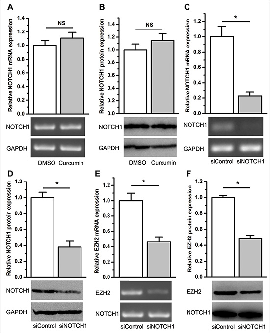 EZH2 abrogated the inhibitory effect of curcumin on NOTCH1 expression, and inhibition of NOTCH1 repressed EZH2 expression.