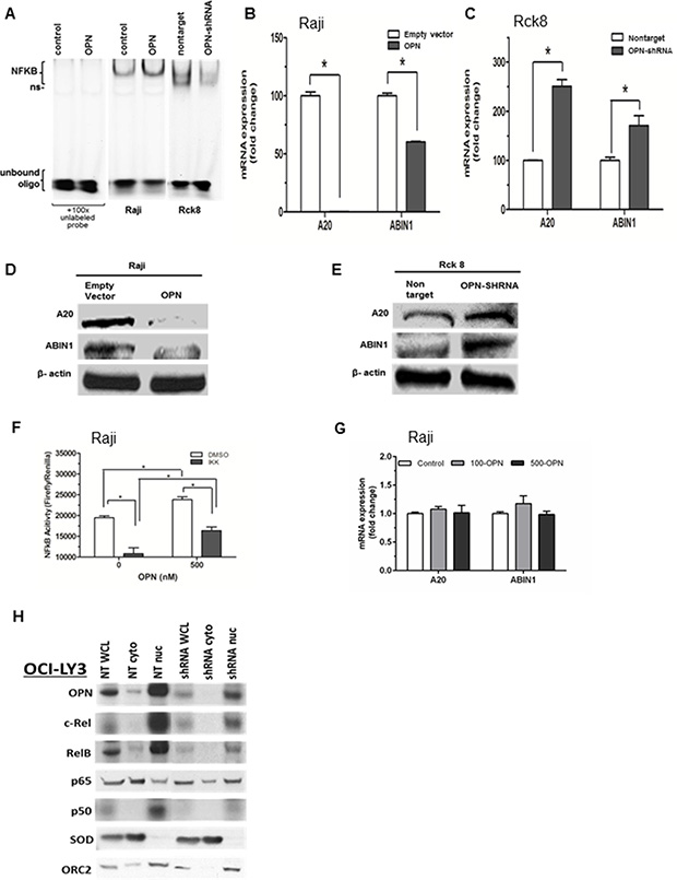 Osteopontin activates NF-&#x03BA;B signaling by a dual mechanism consisting of transcriptional downregulation of A20/TNFAIP3 and ABIN1/TNIP1 by intracellular OPN (iOPN) and an autocrine stimulation of cell membrane receptors by secretory OPN (sOPN).
