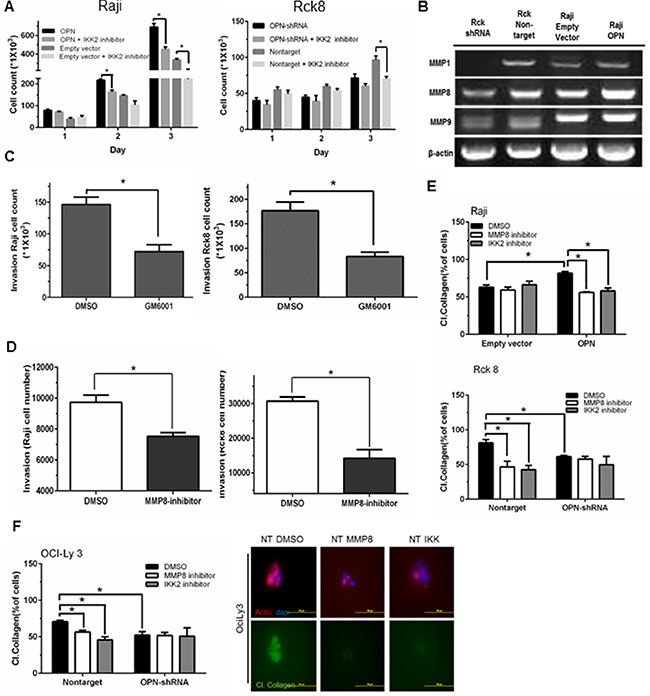 Osteopontin promotes B lymphoma cell proliferation and MMP8-mediated invasion of B lymphoma cells via activation of NF-&#x03BA;B signaling.