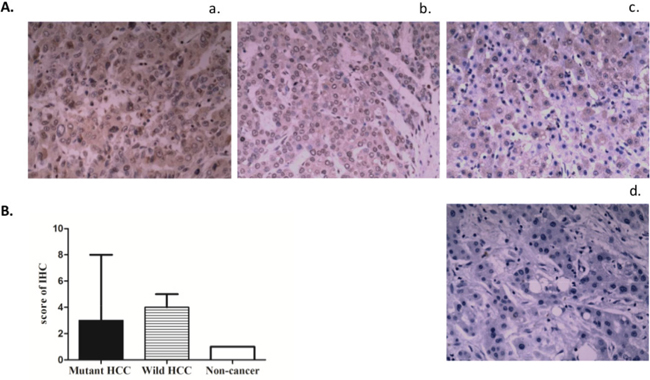 Expression of TERT protein in liver tissues stratified by TERT promoter mutation status.