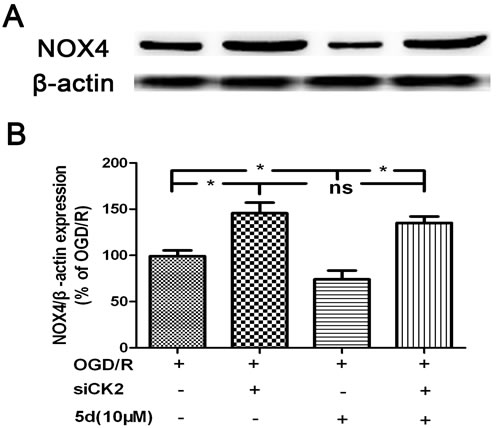 CK2 negatively modulates the expression of NOX4 protein.