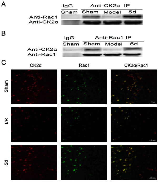 Effects of 5d on the relationship between CK2 and Rac1 protein levels.