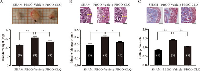 Chloroquine treatment significantly attenuates the bladder morphological changes of PBOO mice.