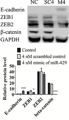 MiR-429 modifies E-cadherin expression in UCC cell line T24 through ZEB1-&#x03B2;-catenin axis in T24 cells.