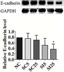E-cadherin knockdown by siRNA in TSGH8301 cells.