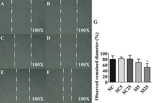 E-cadherin knockdown reduces migratory ability of TSGH8301 cells.