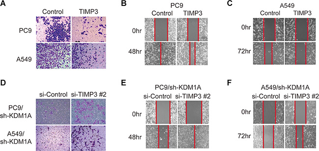 TIMP3 suppresses KDM1A-mediated cell invasion and migration.