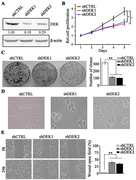 DEK knockdown inhibits cell proliferation and migration in SMMC7721 cells.