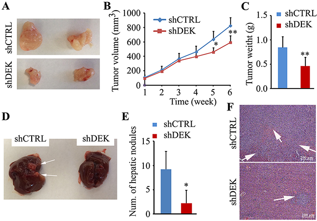 Knockdown of DEK suppresses tumor growth and metastasis in vivo.