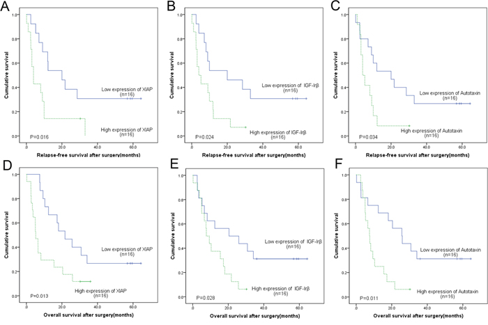 In AFP producing group, the Kaplan&#x2013;Meier and log-rank survival analysis of the relapse-free survival A-C. and overall survival D-F. showed that the group with high level expression of XIAP A, D., IGF-Ir&#x03B2; B, E. and Autotaxin C, F. was associated with poor prognosis.