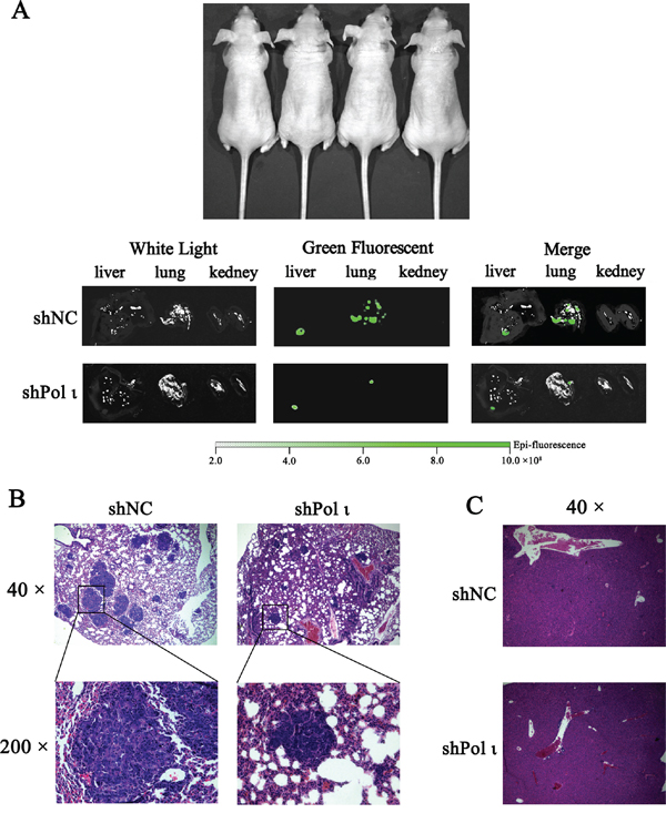 Knockdown of Pol &#x03B9; expression decreases the metastatic potential of KYSE-150 cells in vivo.