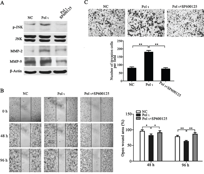 Pol &#x03B9; promotes ESCC cell migration and invasion through the JNK-AP1 pathway.