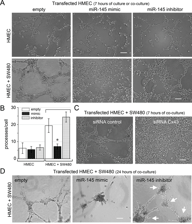 Antiangiogenic effect of miR-145 transfer in vitro.