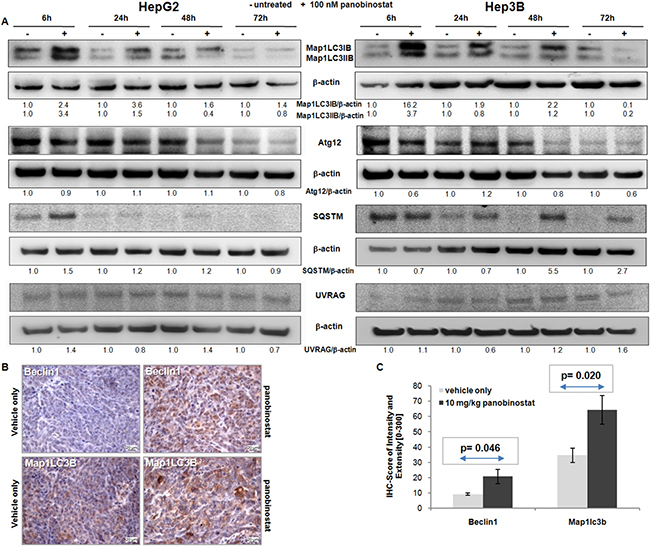 Autophagic protein modulation.