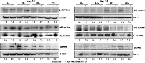 p53 and p73 role during autophagy.