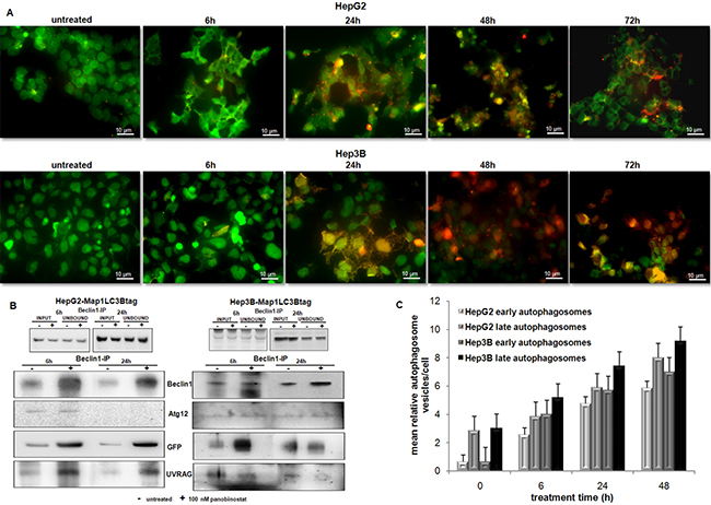 Autophagosome dynamic and aggregation.