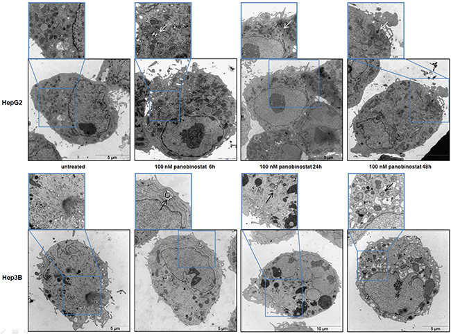 HCC cells ultrastructure analysis.