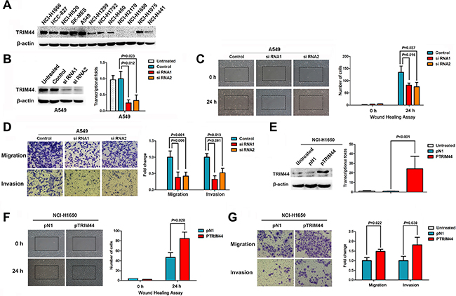 TRIM44 increases the motility and invasive properties of non-small cell lung cancer cells.