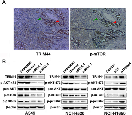 Association between TRIM44 overexpression and mTOR activity.