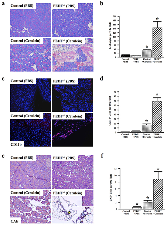 Loss of PEDF enhances cerulein-induced inflammation and fibrosis.