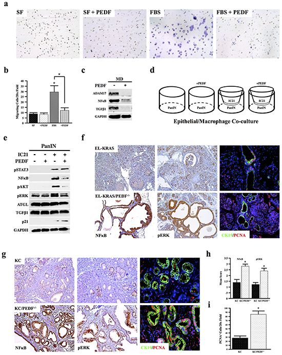 PEDF inhibits macrophage activation in vitro.