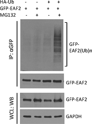 Polyubiquitination of GFP-EAF2 protein.