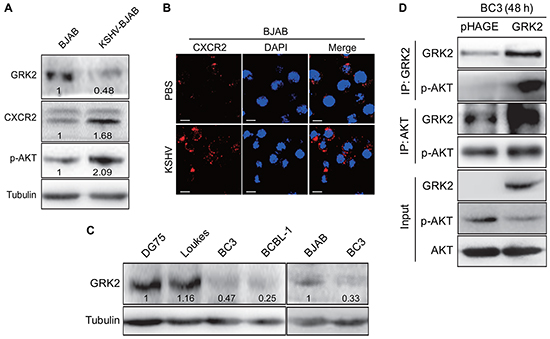 The GRK2/CXCR2/AKT pathway is changed in B lymphoma cells infected by KSHV.
