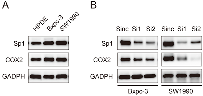 Sp1 promotes the expression of COX2 in human pancreatic cancer cell lines.