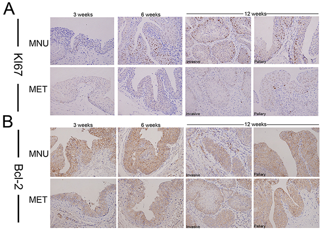 The effect of metformin on the expression of Ki67 and Bcl-2 in bladder cancers development.