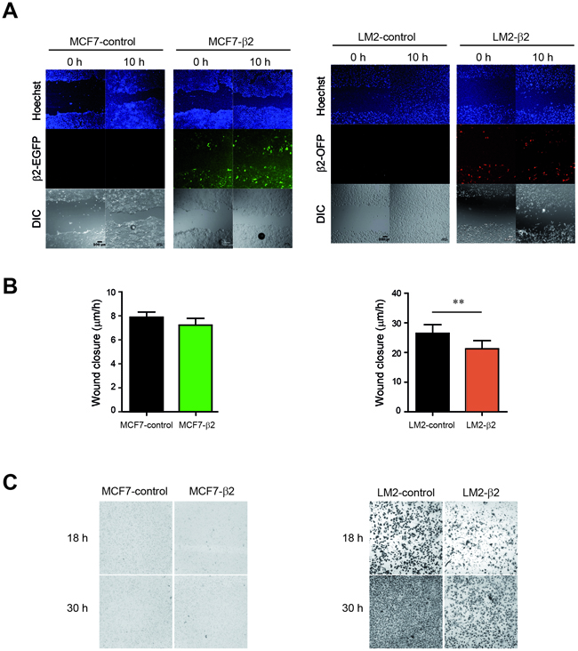 &#x03B2;2-chimaerin differentially affects cell migration and invasion in epithelial or mesenchymal-like cells.