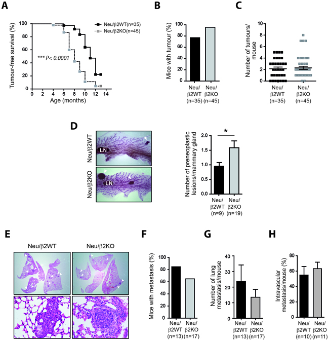 &#x03B2;2-chimaerin deficiency accelerates mammary tumor onset but delays tumor progression in vivo.
