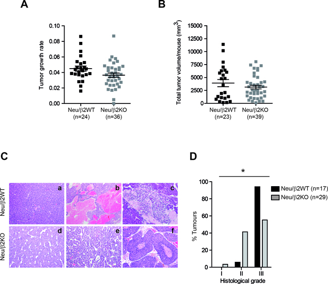 &#x03B2;2-chimaerin deficiency correlates with lower mammary tumor grade.